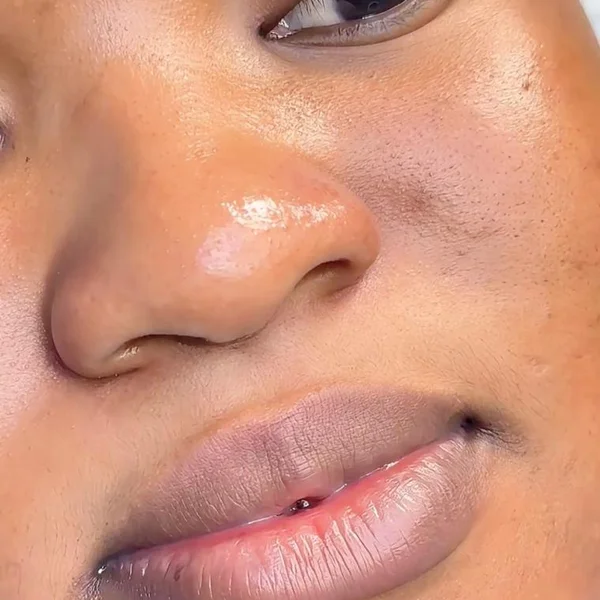 Neutralisation des Lèvres — Avant