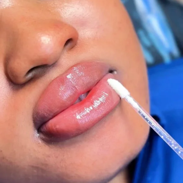 Neutralisation des Lèvres — Avant / Après