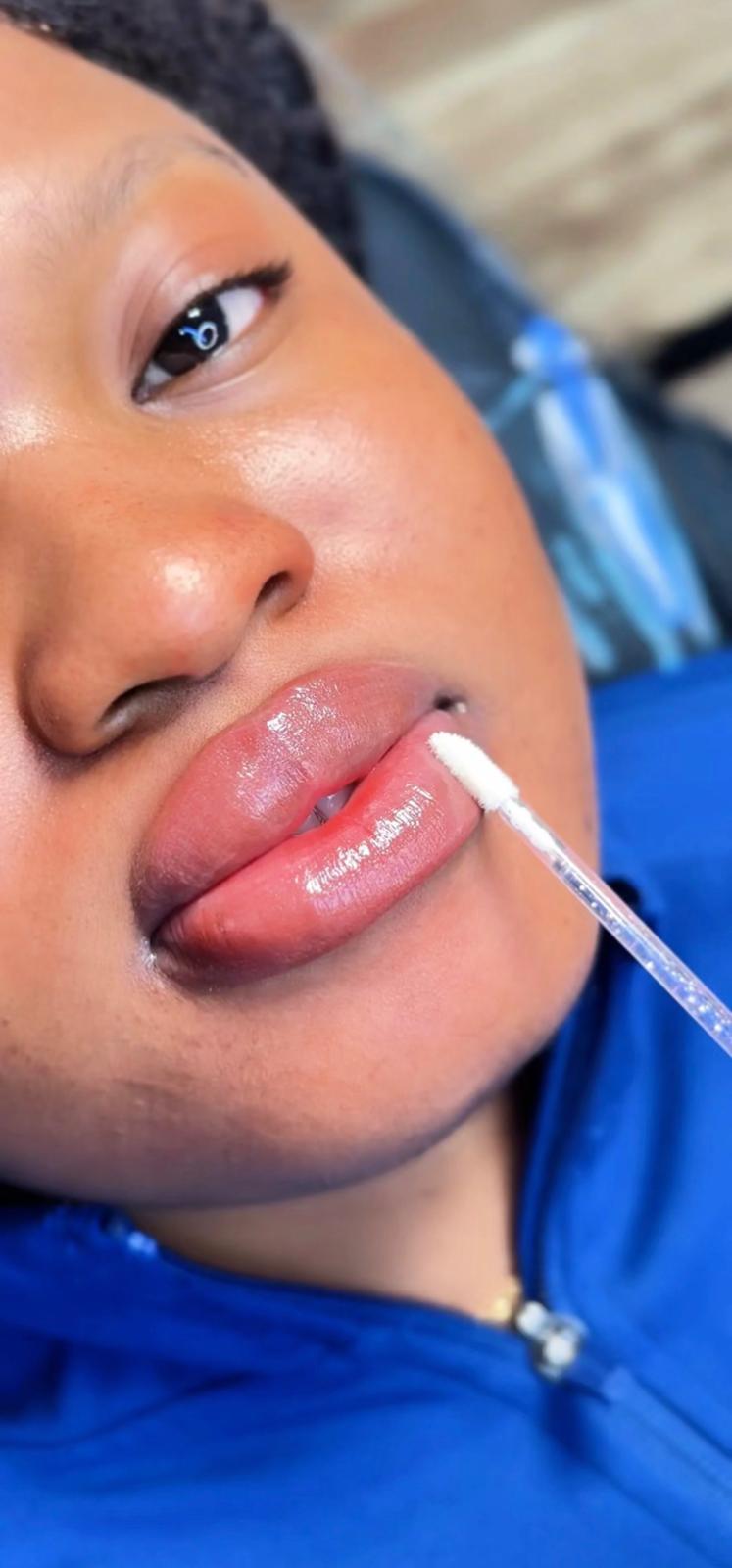 Lip Neutralization — Après