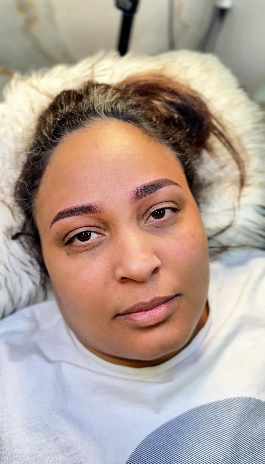 Microshading — Après